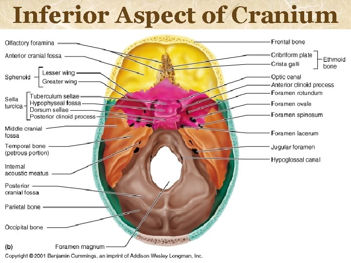 Inferior Aspect of Cranium 