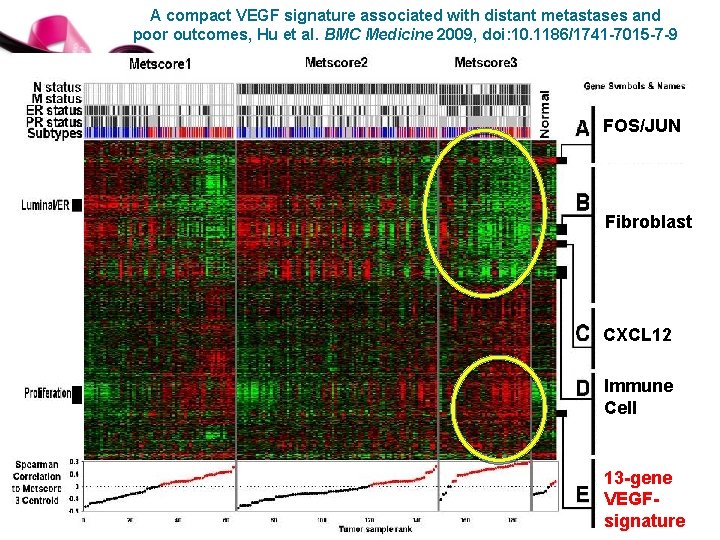 A compact VEGF signature associated with distant metastases and poor outcomes, Hu et al.