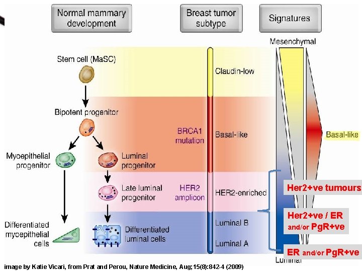 Her 2+ve tumours Her 2+ve / ER and/or Pg. R+ve image by Katie Vicari,