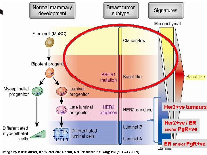 Her 2+ve tumours Her 2+ve / ER and/or Pg. R+ve image by Katie Vicari,