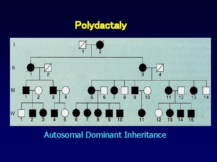 Polydactaly Autosomal Dominant Inheritance 