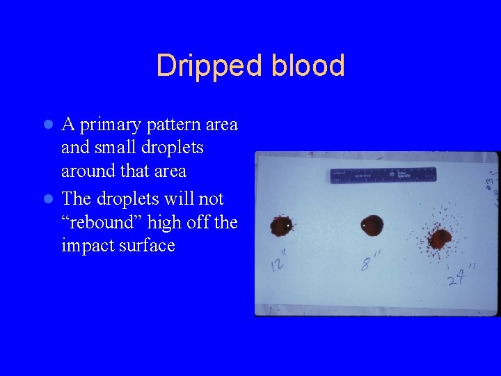 Dripped blood A primary pattern area and small droplets around that area l The