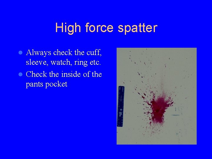 High force spatter Always check the cuff, sleeve, watch, ring etc. l Check the