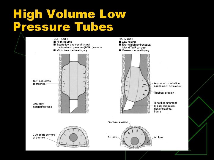 High Volume Low Pressure Tubes 