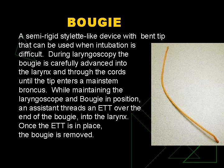 BOUGIE A semi-rigid stylette-like device with bent tip that can be used when intubation