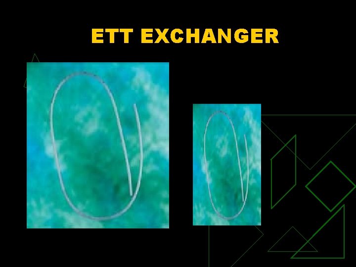 ETT EXCHANGER 