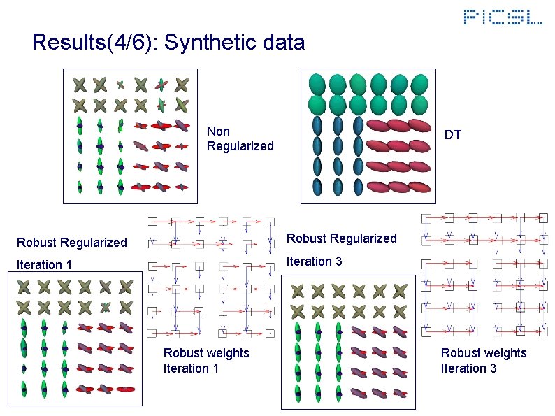 Results(4/6): Synthetic data Non Regularized DT Robust Regularized Iteration 1 Iteration 3 Robust weights