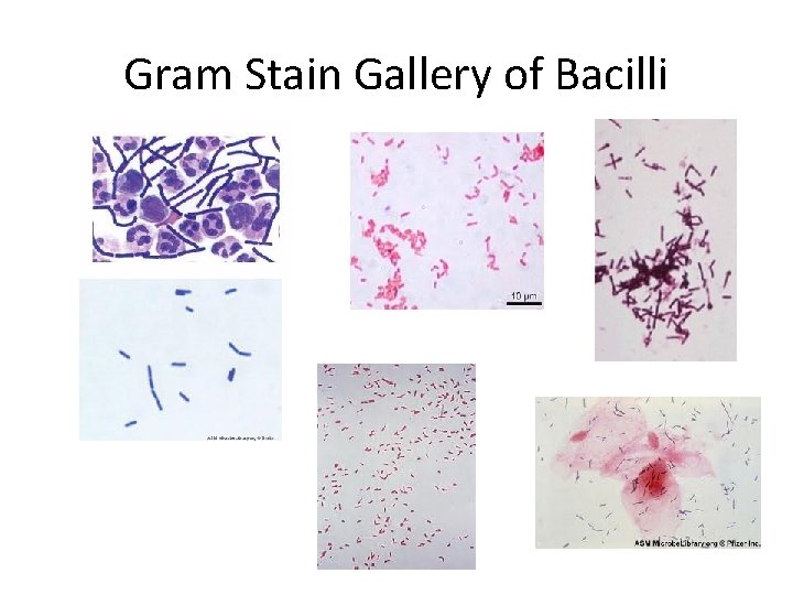 Gram Stain Gallery of Bacilli 