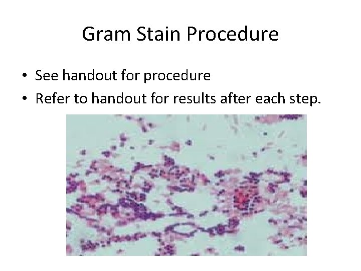 Gram Stain Procedure • See handout for procedure • Refer to handout for results