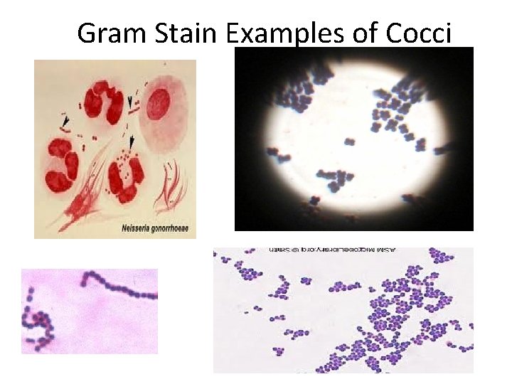 Gram Stain Examples of Cocci 