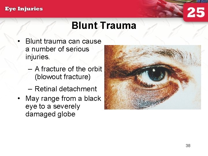 Blunt Trauma • Blunt trauma can cause a number of serious injuries. – A