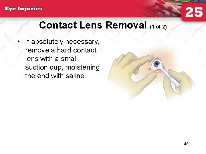 Contact Lens Removal (1 of 2) • If absolutely necessary, remove a hard contact