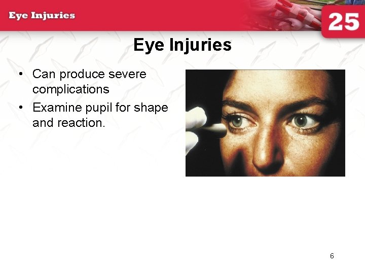 Eye Injuries • Can produce severe complications • Examine pupil for shape and reaction.