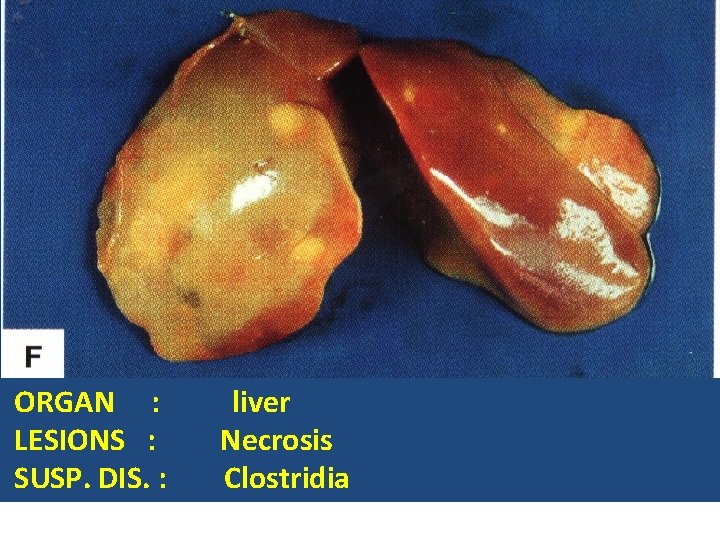 ORGAN : LESIONS : SUSP. DIS. : liver Necrosis Clostridia 