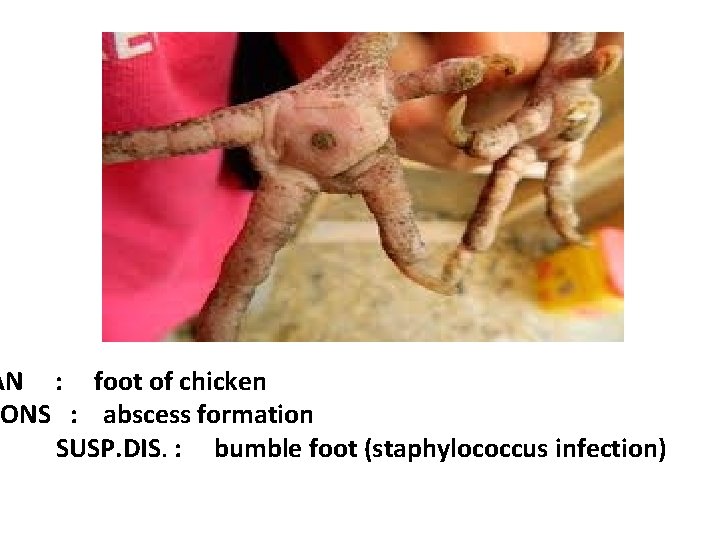 AN : foot of chicken IONS : abscess formation SUSP. DIS. : bumble foot