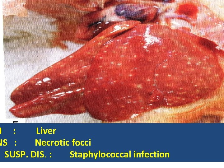 N : Liver NS : Necrotic focci SUSP. DIS. : Staphylococcal infection 