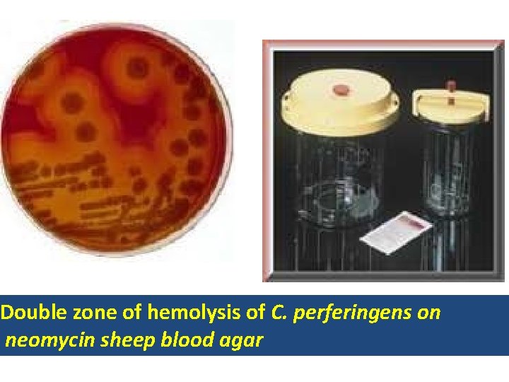 Double zone of hemolysis of C. perferingens on neomycin sheep blood agar 