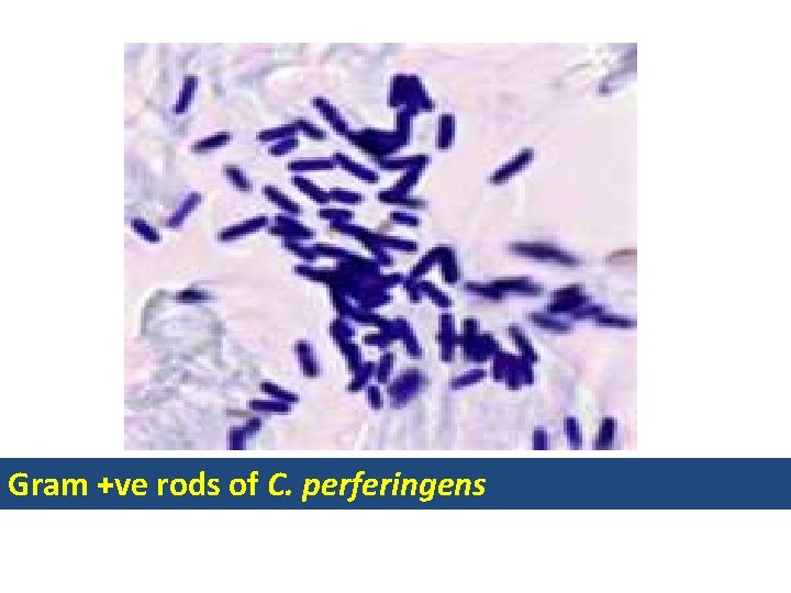 Gram +ve rods of C. perferingens 