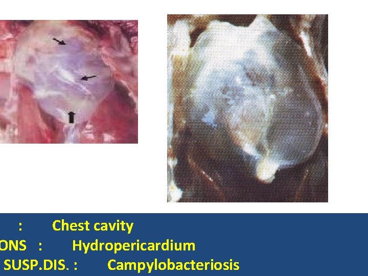 : Chest cavity ONS : Hydropericardium SUSP. DIS. : Campylobacteriosis 