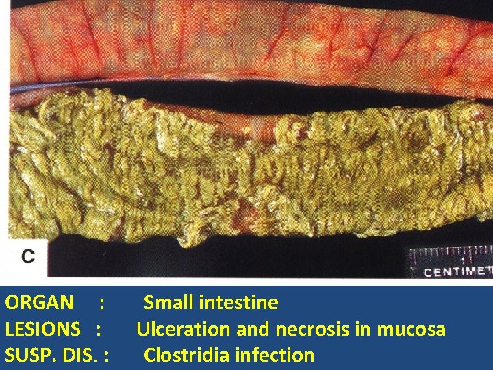 ORGAN : LESIONS : SUSP. DIS. : Small intestine Ulceration and necrosis in mucosa