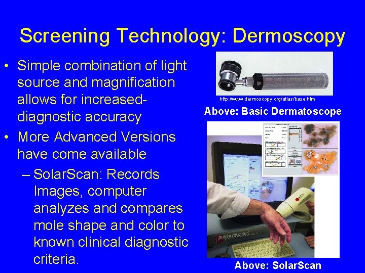 Screening Technology: Dermoscopy • Simple combination of light source and magnification allows for increaseddiagnostic
