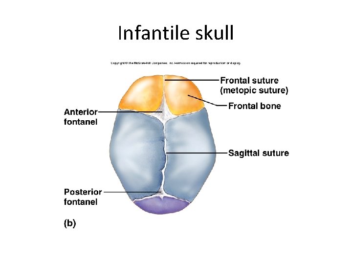 Infantile skull 