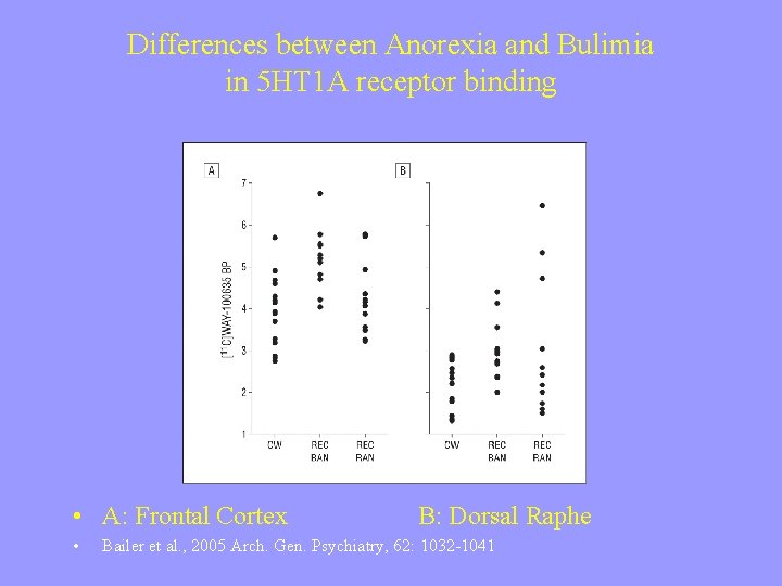 Differences between Anorexia and Bulimia in 5 HT 1 A receptor binding • A: