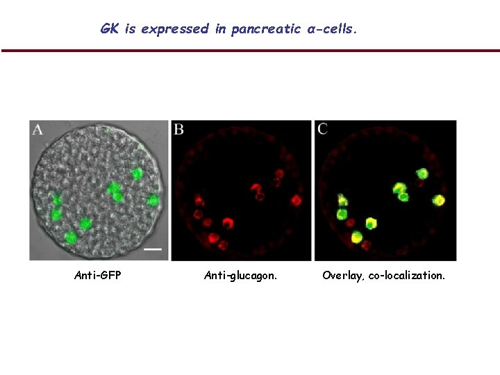 GK is expressed in pancreatic α-cells. Anti-GFP Anti-glucagon. Overlay, co-localization. 