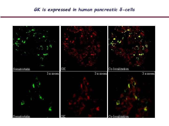 GK is expressed in human pancreatic δ-cells GK Somatostatin 3 x zoom Somatostatin Co-localization