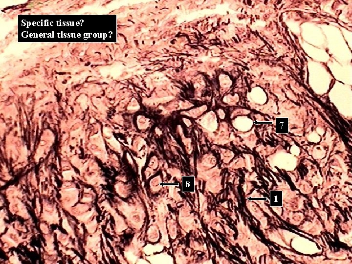 Specific tissue? General tissue group? 7 8 1 