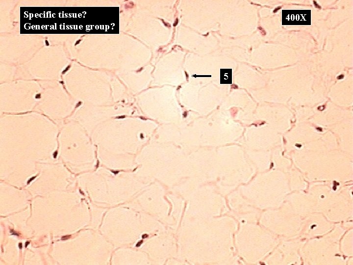 Specific tissue? General tissue group? 400 X 5 