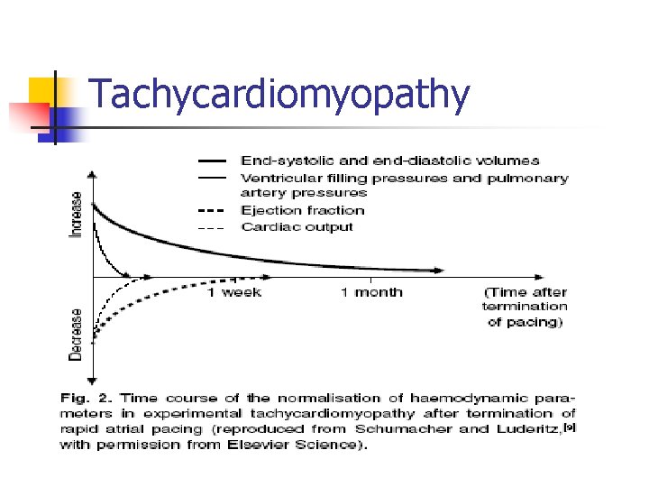 Tachycardiomyopathy 