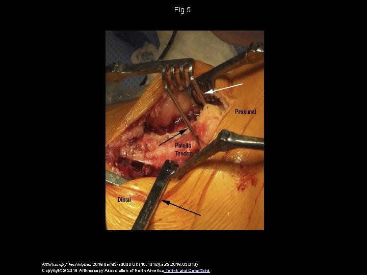 Fig 5 Arthroscopy Techniques 2019 8 e 793 -e 800 DOI: (10. 1016/j. eats.
