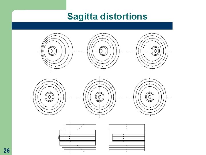Sagitta distortions 26 