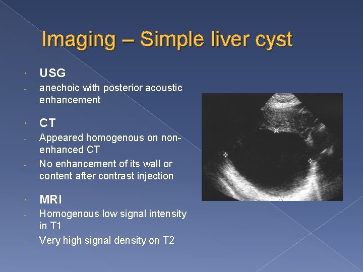 Imaging – Simple liver cyst USG - anechoic with posterior acoustic enhancement CT -
