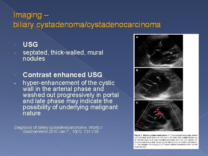 Imaging – biliary cystadenoma/cystadenocarcinoma USG - septated, thick-walled, mural nodules Contrast enhanced USG -