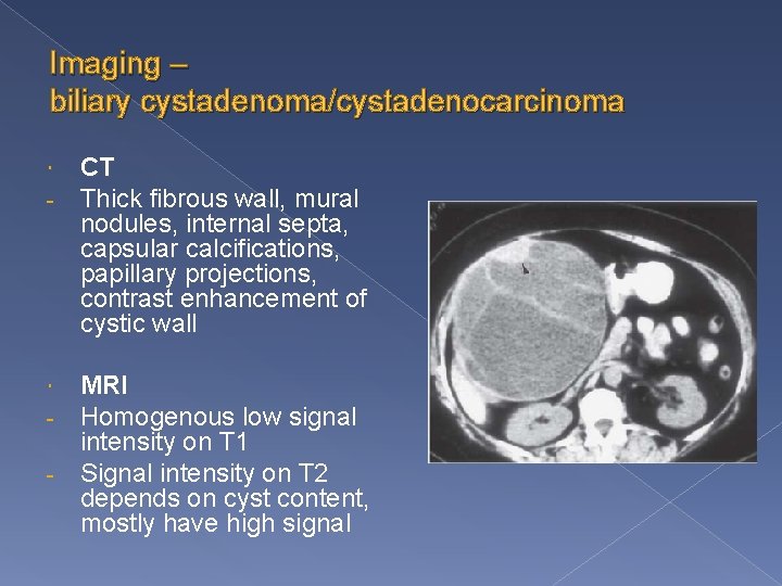 Imaging – biliary cystadenoma/cystadenocarcinoma - CT Thick fibrous wall, mural nodules, internal septa, capsular