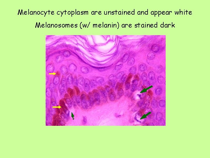 Melanocyte cytoplasm are unstained and appear white Melanosomes (w/ melanin) are stained dark 