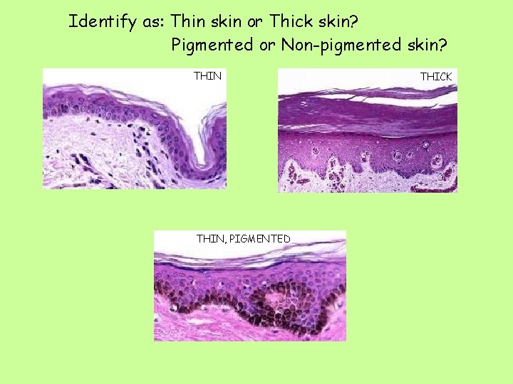 Identify as: Thin skin or Thick skin? Pigmented or Non-pigmented skin? THIN, PIGMENTED THICK