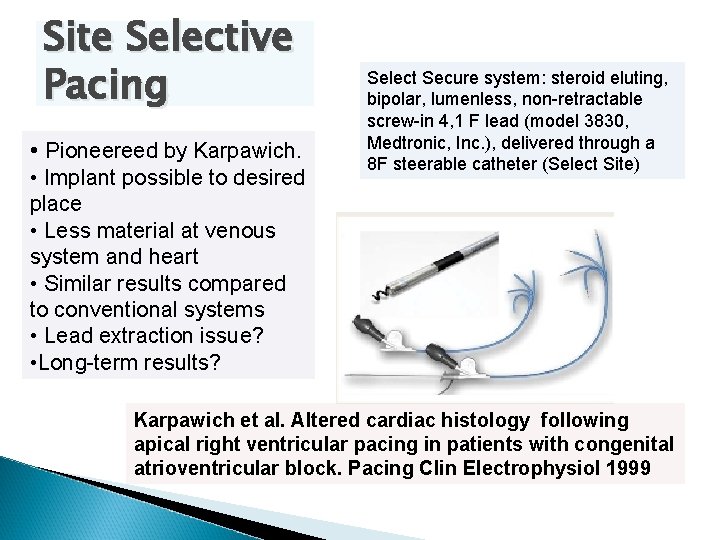 Site Selective Pacing • Pioneereed by Karpawich. • Implant possible to desired place •