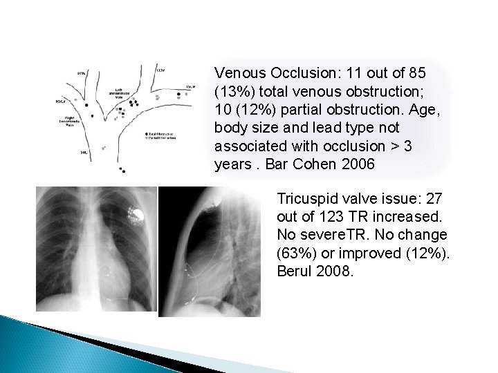 Venous Occlusion: 11 out of 85 (13%) total venous obstruction; 10 (12%) partial obstruction.