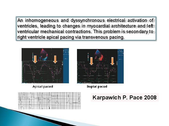 An inhomogeneous and dyssynchronous electrical activation of ventricles, leading to changes in myocardial architecture