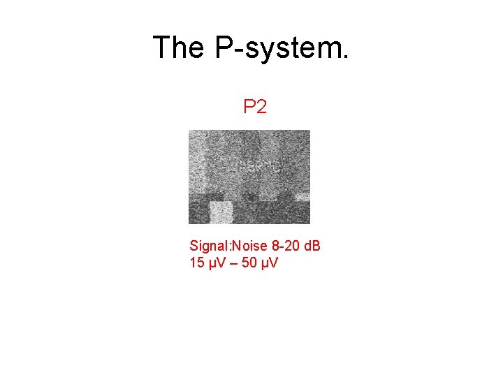 The P-system. P 2 Signal: Noise 8 -20 d. B 15 µV – 50