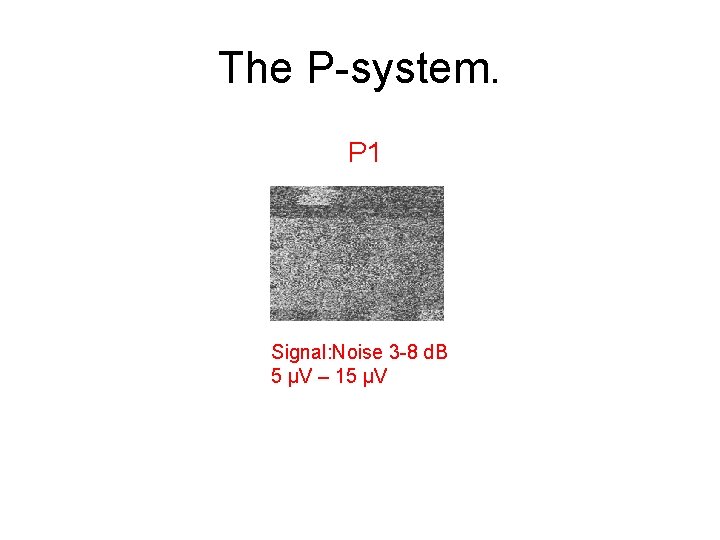 The P-system. P 1 Signal: Noise 3 -8 d. B 5 µV – 15