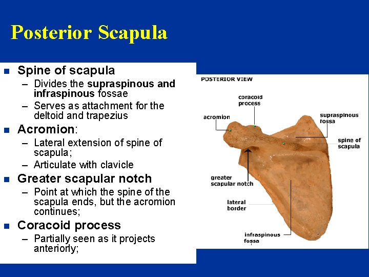 Posterior Scapula n Spine of scapula – Divides the supraspinous and infraspinous fossae –