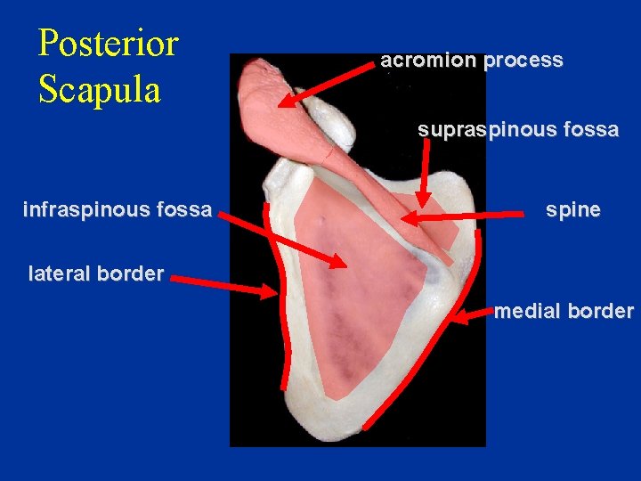 Posterior Scapula acromion process supraspinous fossa infraspinous fossa spine lateral border medial border 