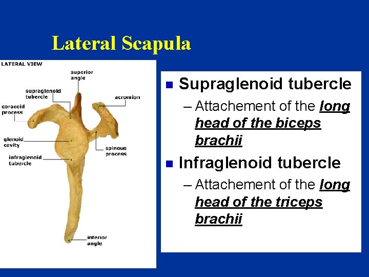 Lateral Scapula n Supraglenoid tubercle – Attachement of the long head of the biceps