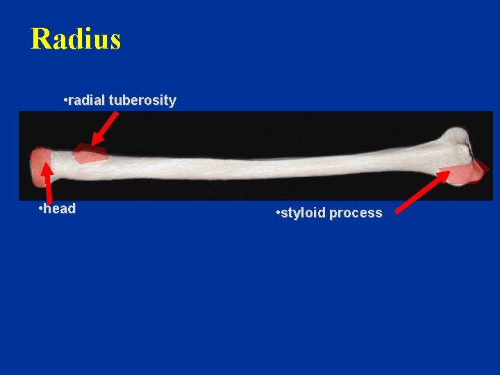 Radius • radial tuberosity • head • styloid process 