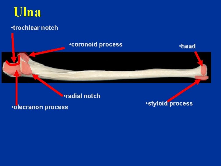 Ulna • trochlear notch • coronoid process • head • radial notch • olecranon