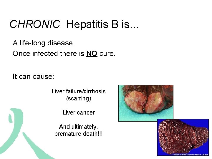 CHRONIC Hepatitis B is… A life-long disease. Once infected there is NO cure. It